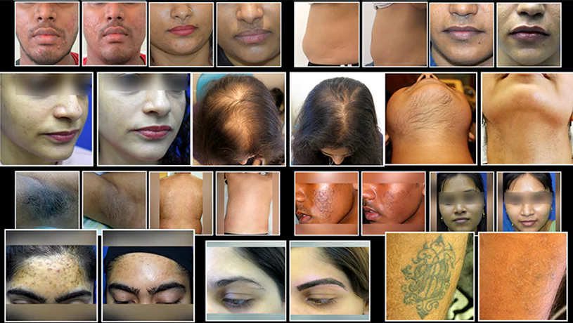 Dermatologist in Mumbai